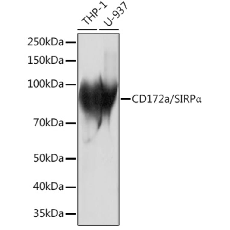 Western Blot - Anti-SIRP alpha Antibody [ARC1626] (A308467) - Antibodies.com