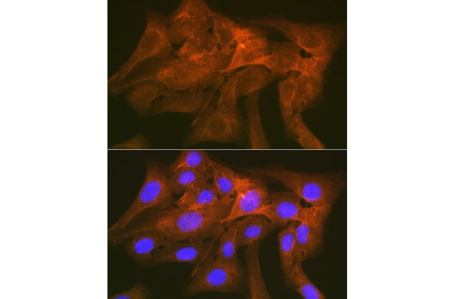 Immunofluorescence - Anti-SIRP alpha Antibody [ARC1626] (A308467) - Antibodies.com
