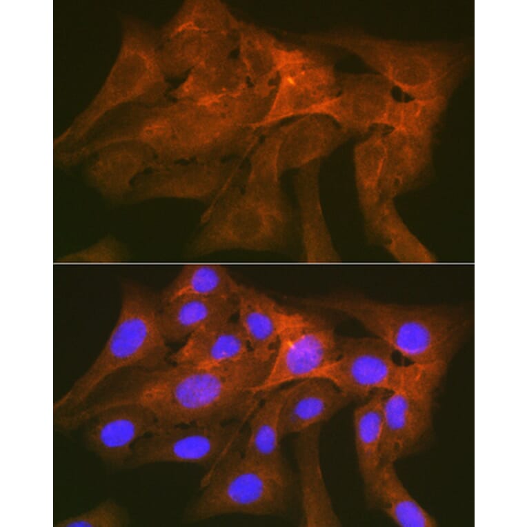 Immunofluorescence - Anti-SIRP alpha Antibody [ARC1626] (A308467) - Antibodies.com