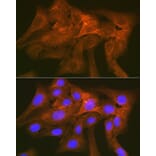 Immunofluorescence - Anti-SIRP alpha Antibody [ARC1626] (A308467) - Antibodies.com