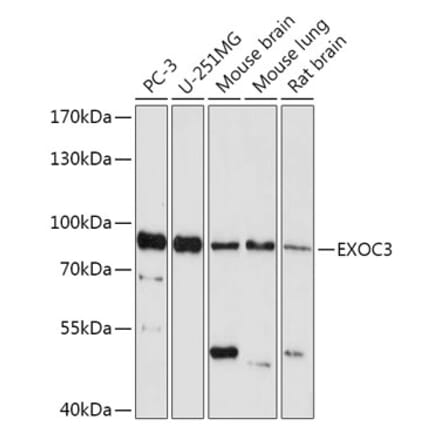 Western Blot - Anti-rSec6 Antibody (A308468) - Antibodies.com