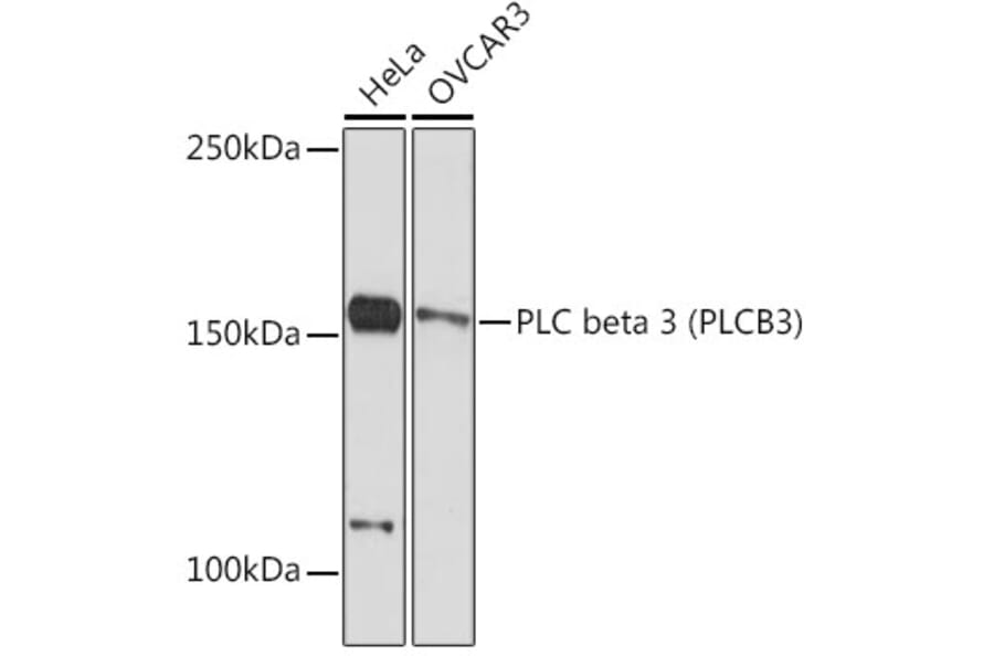 Western Blot - Anti-Phospholipase C beta 3/PLCB3 Antibody [ARC2269] (A308469) - Antibodies.com
