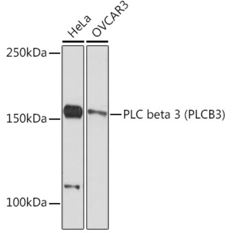 Western Blot - Anti-Phospholipase C beta 3/PLCB3 Antibody [ARC2269] (A308469) - Antibodies.com