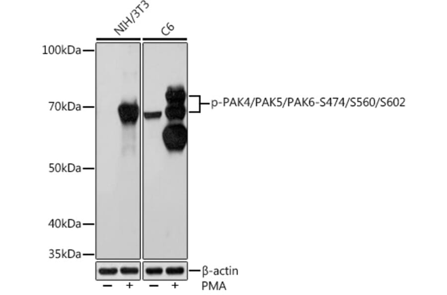 Western Blot - Anti-PAK4 + PAK5 + PAK6 (phospho Ser474 + Ser560 + Ser602) Antibody [ARC1596] (A308470) - Antibodies.com
