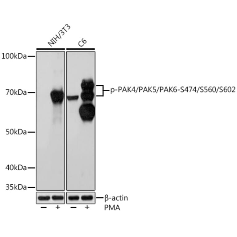 Western Blot - Anti-PAK4 + PAK5 + PAK6 (phospho Ser474 + Ser560 + Ser602) Antibody [ARC1596] (A308470) - Antibodies.com