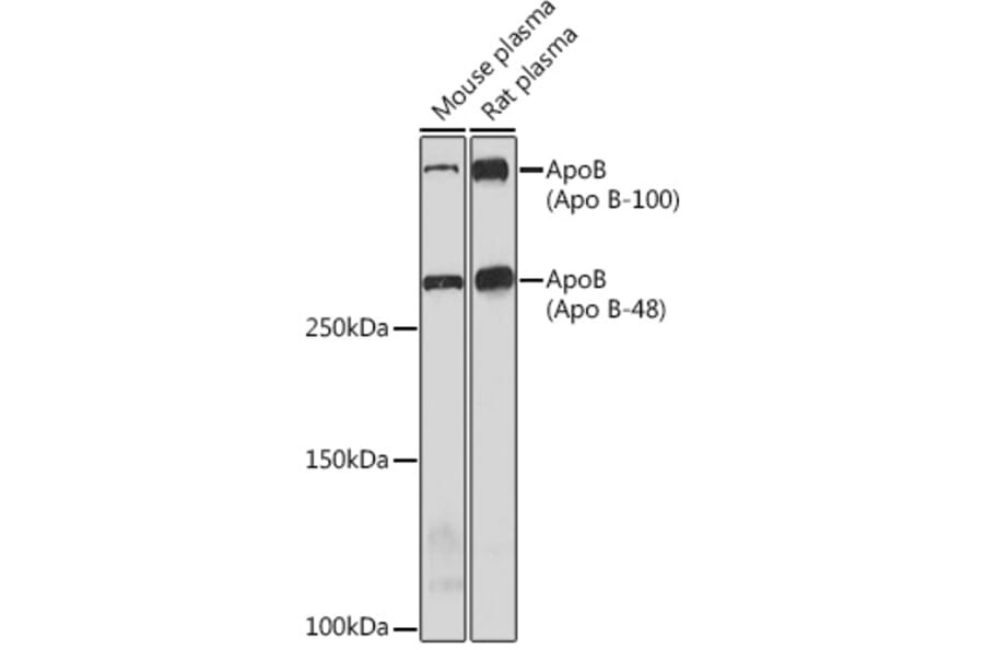 Western Blot - Anti-Apolipoprotein B Antibody [ARC0920] (A308472) - Antibodies.com