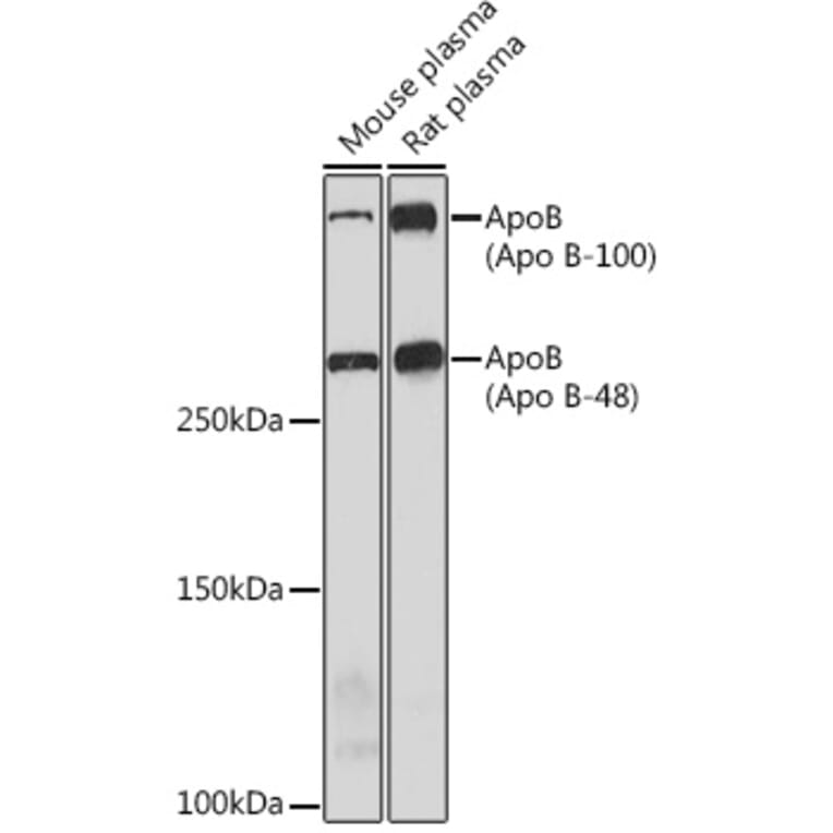 Western Blot - Anti-Apolipoprotein B Antibody [ARC0920] (A308472) - Antibodies.com