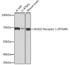 Western Blot - Anti-Nogo Receptor Antibody [ARC0872] (A308473) - Antibodies.com