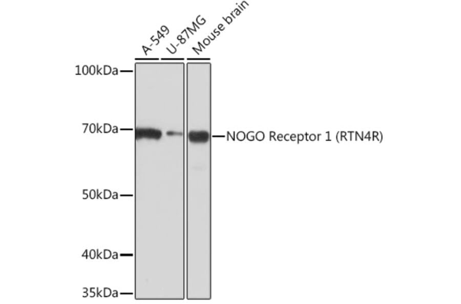 Western Blot - Anti-Nogo Receptor Antibody [ARC0872] (A308473) - Antibodies.com