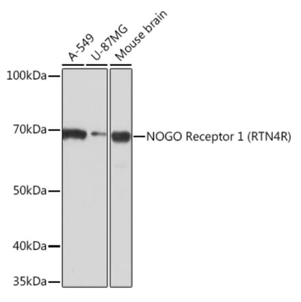 Western Blot - Anti-Nogo Receptor Antibody [ARC0872] (A308473) - Antibodies.com