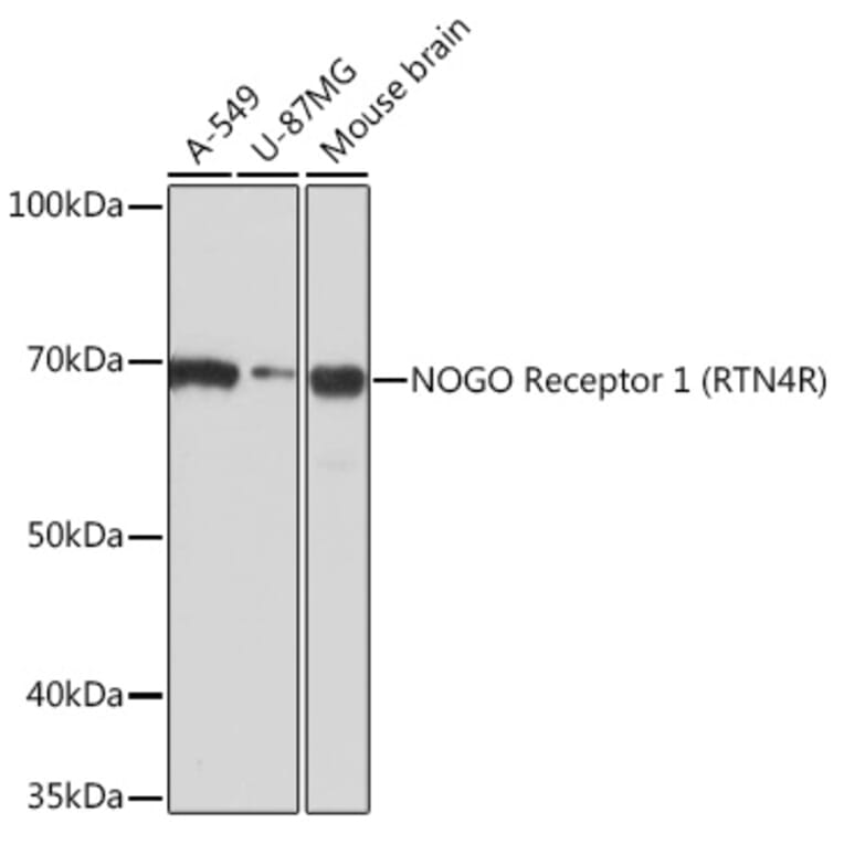 Western Blot - Anti-Nogo Receptor Antibody [ARC0872] (A308473) - Antibodies.com