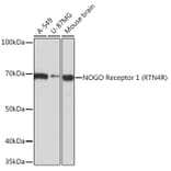 Western Blot - Anti-Nogo Receptor Antibody [ARC0872] (A308473) - Antibodies.com