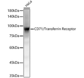 Western Blot - Anti-Transferrin Receptor Antibody [ARC54396] (A308474) - Antibodies.com