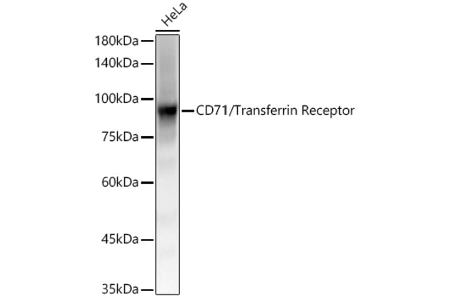 Western Blot - Anti-Transferrin Receptor Antibody [ARC54396] (A308474) - Antibodies.com