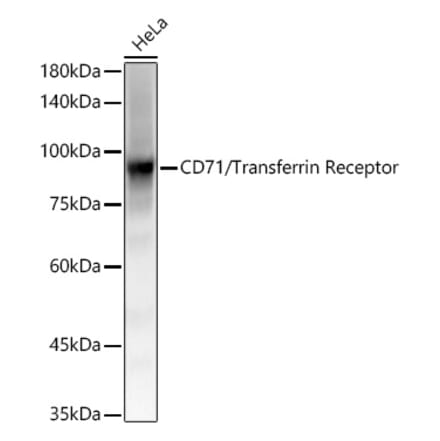 Western Blot - Anti-Transferrin Receptor Antibody [ARC54396] (A308474) - Antibodies.com