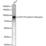 Western Blot - Anti-Transferrin Receptor Antibody [ARC54396] (A308474) - Antibodies.com