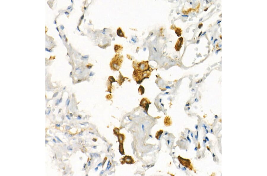 Immunohistochemistry - Anti-Transferrin Receptor Antibody [ARC54396] (A308474) - Antibodies.com