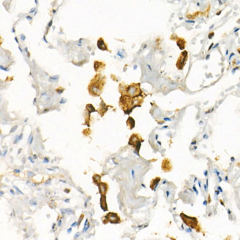 Immunohistochemistry - Anti-Transferrin Receptor Antibody [ARC54396] (A308474) - Antibodies.com