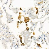 Immunohistochemistry - Anti-Transferrin Receptor Antibody [ARC54396] (A308474) - Antibodies.com
