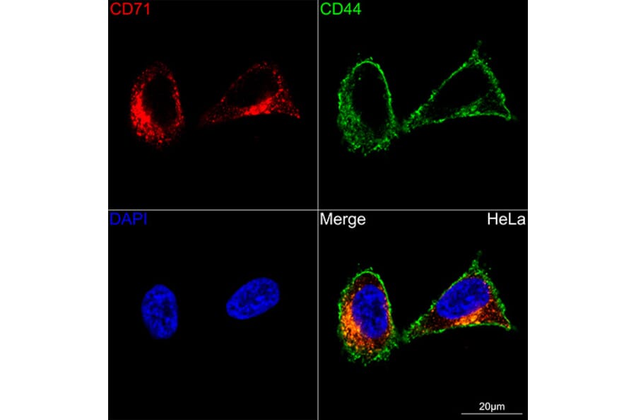 Immunofluorescence - Anti-Transferrin Receptor Antibody [ARC54396] (A308474) - Antibodies.com
