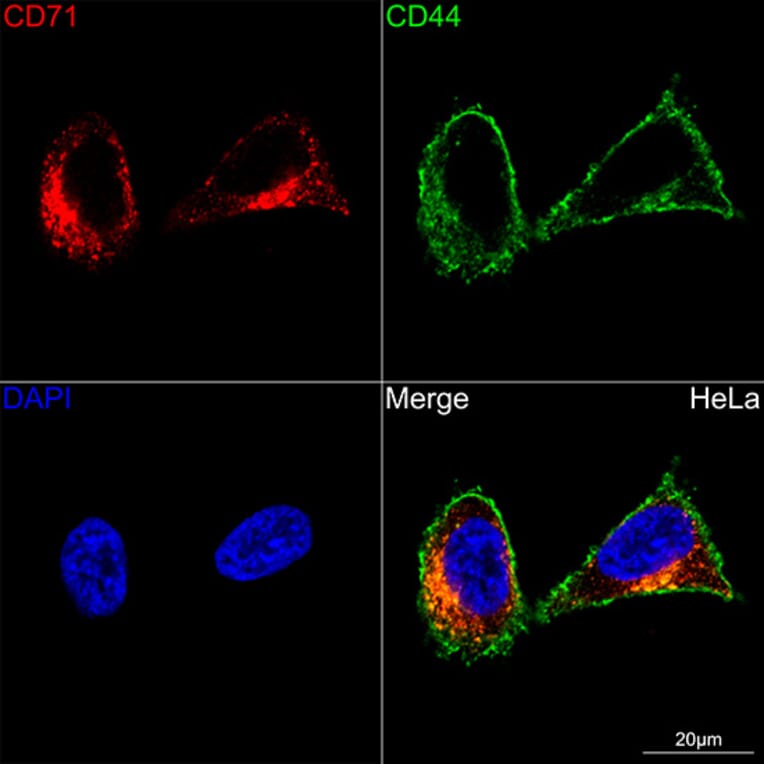 Immunofluorescence - Anti-Transferrin Receptor Antibody [ARC54396] (A308474) - Antibodies.com