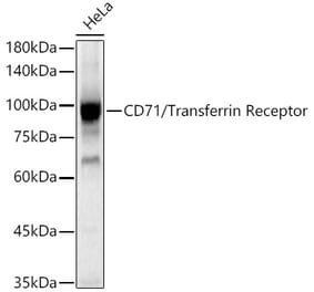 Western Blot - Anti-Transferrin Receptor Antibody (A308475) - Antibodies.com