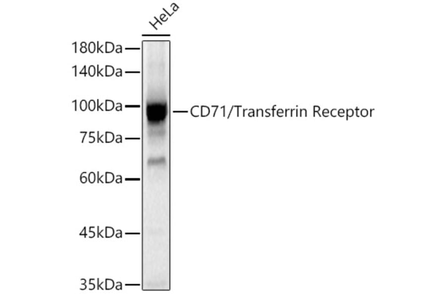 Western Blot - Anti-Transferrin Receptor Antibody (A308475) - Antibodies.com