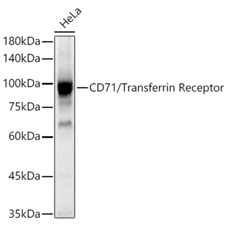 Western Blot - Anti-Transferrin Receptor Antibody (A308475) - Antibodies.com