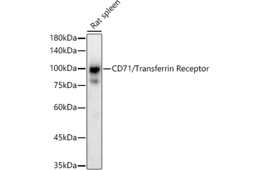 Western Blot - Anti-Transferrin Receptor Antibody (A308475) - Antibodies.com