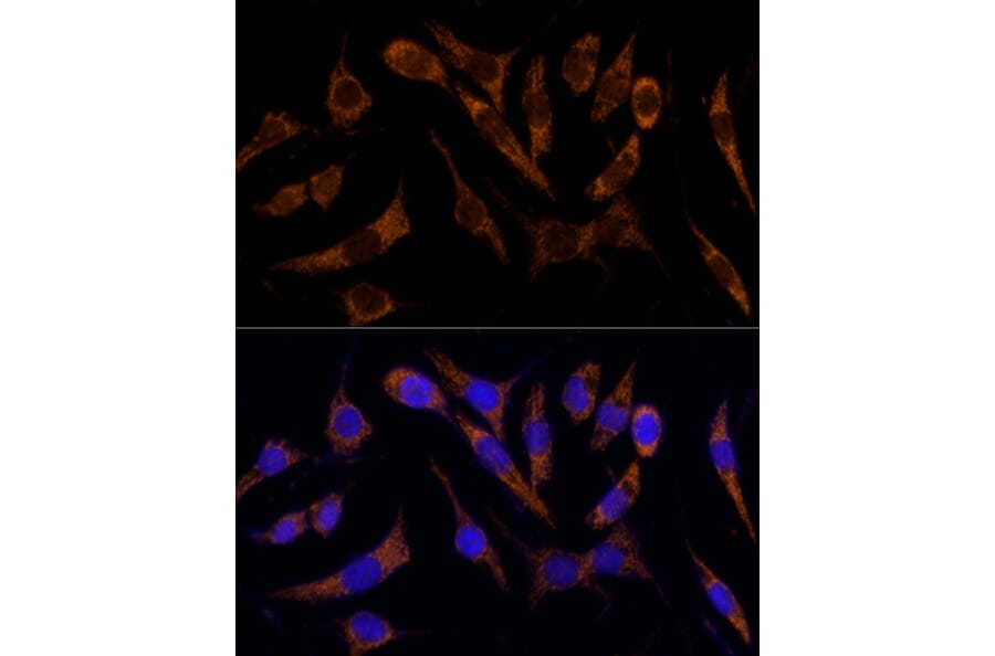 Immunofluorescence - Anti-Transferrin Receptor Antibody (A308475) - Antibodies.com