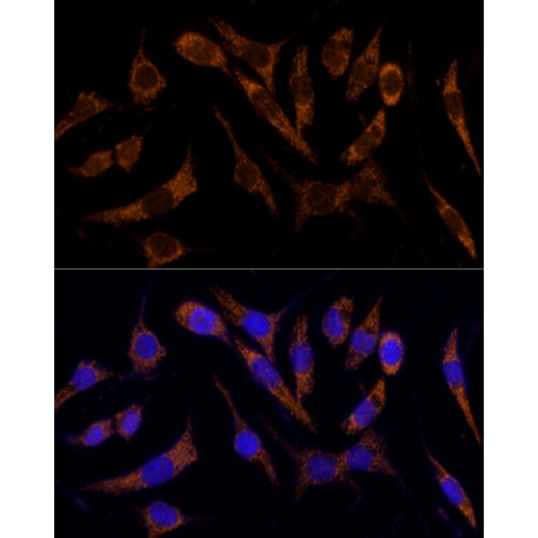 Immunofluorescence - Anti-Transferrin Receptor Antibody (A308475) - Antibodies.com