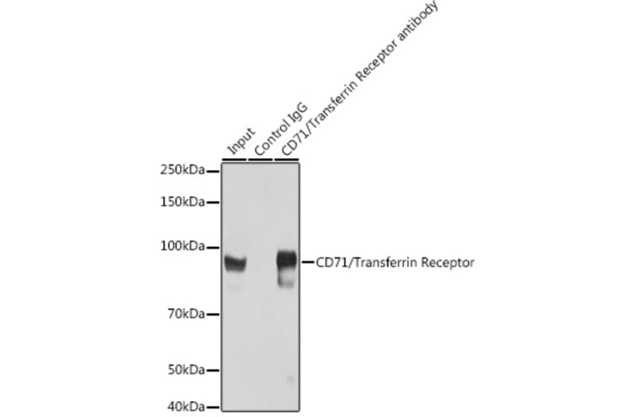 Western Blot - Anti-Transferrin Receptor Antibody (A308475) - Antibodies.com