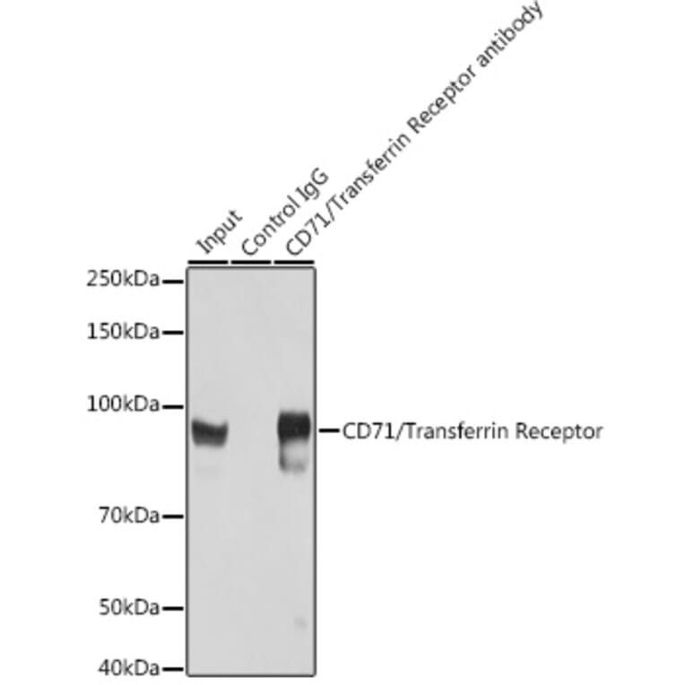 Western Blot - Anti-Transferrin Receptor Antibody (A308475) - Antibodies.com