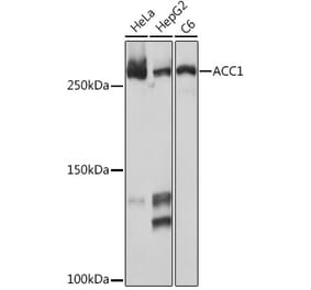 Western Blot - Anti-Acetyl Coenzyme A carboxylase alpha Antibody [ARC2201] (A308476) - Antibodies.com