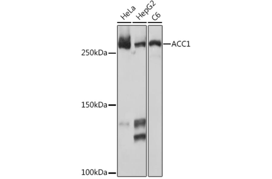 Western Blot - Anti-Acetyl Coenzyme A carboxylase alpha Antibody [ARC2201] (A308476) - Antibodies.com