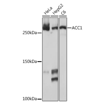 Western Blot - Anti-Acetyl Coenzyme A carboxylase alpha Antibody [ARC2201] (A308476) - Antibodies.com