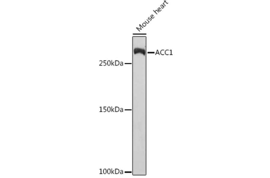 Western Blot - Anti-Acetyl Coenzyme A carboxylase alpha Antibody [ARC2201] (A308476) - Antibodies.com