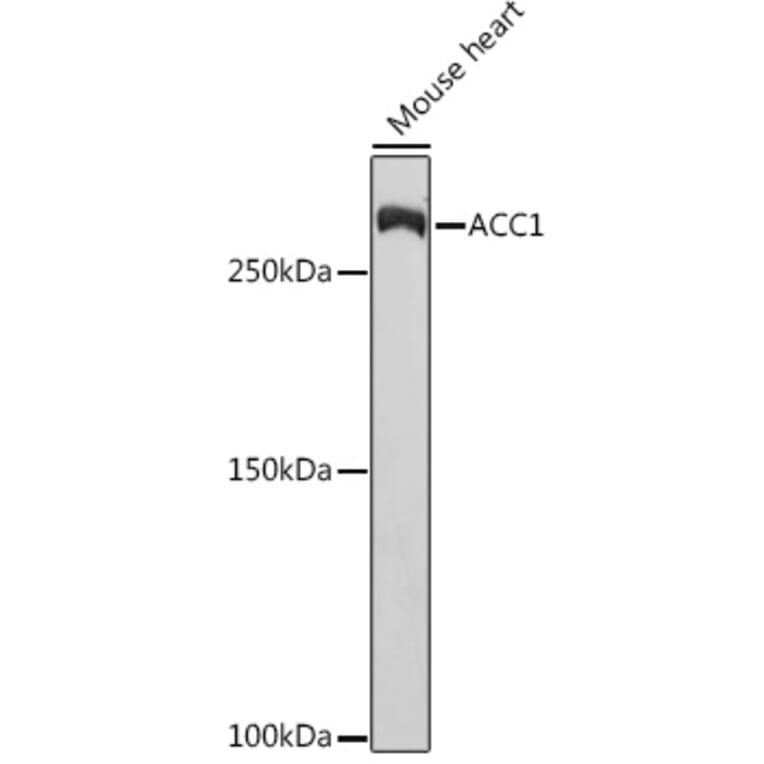 Western Blot - Anti-Acetyl Coenzyme A carboxylase alpha Antibody [ARC2201] (A308476) - Antibodies.com