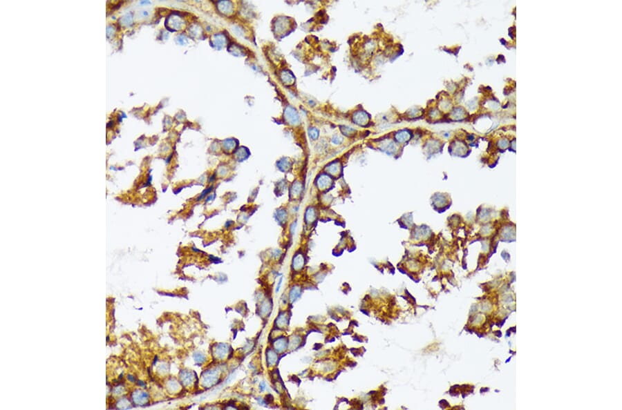 Immunohistochemistry - Anti-Acetyl Coenzyme A carboxylase alpha Antibody [ARC2201] (A308476) - Antibodies.com