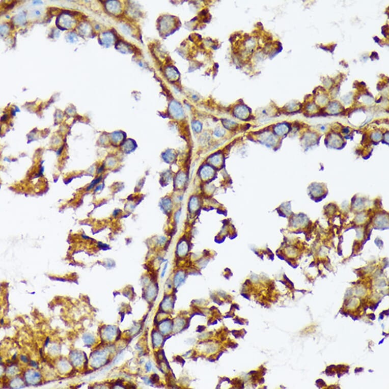 Immunohistochemistry - Anti-Acetyl Coenzyme A carboxylase alpha Antibody [ARC2201] (A308476) - Antibodies.com