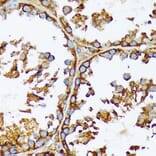 Immunohistochemistry - Anti-Acetyl Coenzyme A carboxylase alpha Antibody [ARC2201] (A308476) - Antibodies.com