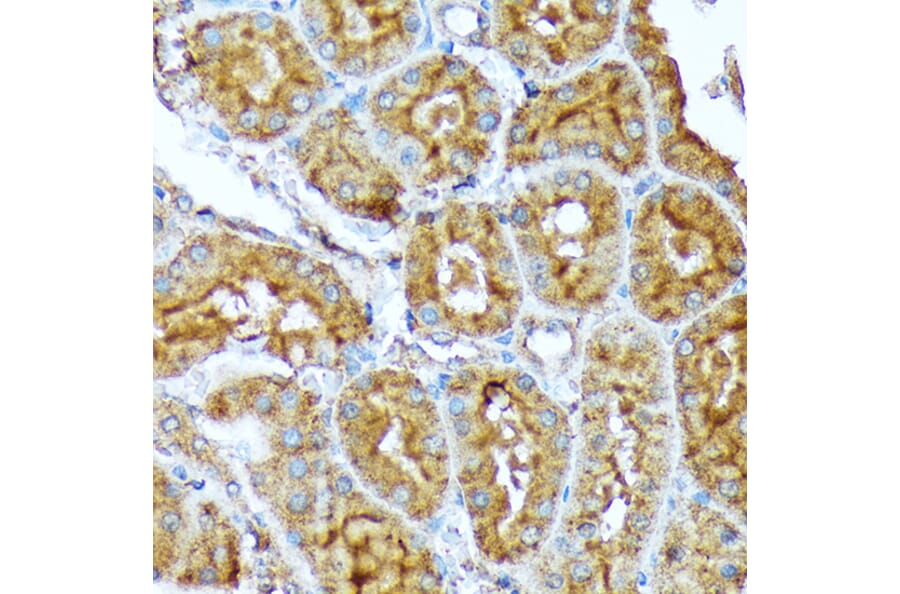 Immunohistochemistry - Anti-Acetyl Coenzyme A carboxylase alpha Antibody [ARC2201] (A308476) - Antibodies.com