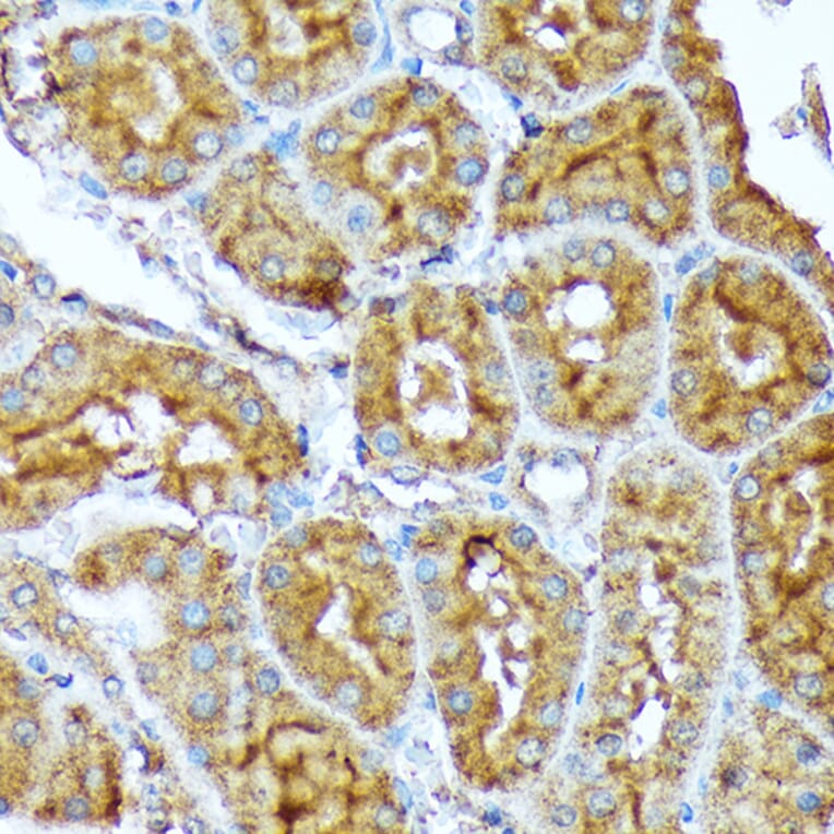 Immunohistochemistry - Anti-Acetyl Coenzyme A carboxylase alpha Antibody [ARC2201] (A308476) - Antibodies.com