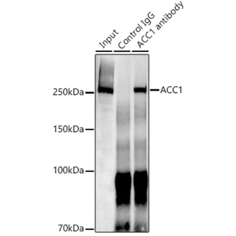 Western Blot - Anti-Acetyl Coenzyme A carboxylase alpha Antibody [ARC2201] (A308476) - Antibodies.com