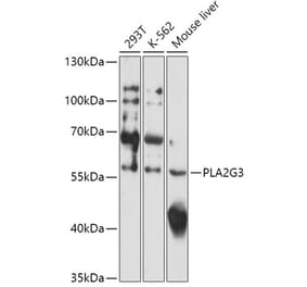 Western Blot - Anti-PLA2G3 Antibody (A308477) - Antibodies.com