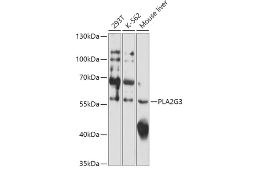 Western Blot - Anti-PLA2G3 Antibody (A308477) - Antibodies.com