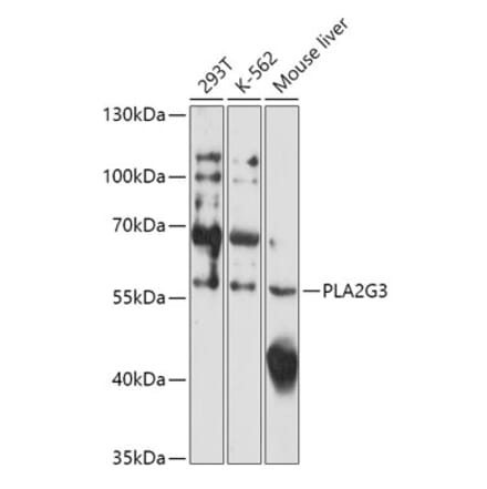 Western Blot - Anti-PLA2G3 Antibody (A308477) - Antibodies.com