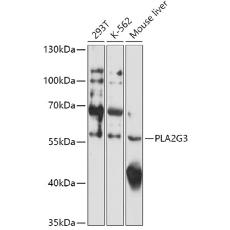 Western Blot - Anti-PLA2G3 Antibody (A308477) - Antibodies.com