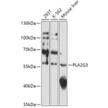 Western Blot - Anti-PLA2G3 Antibody (A308477) - Antibodies.com