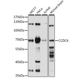 Western Blot - Anti-CCDC6 Antibody (A308478) - Antibodies.com